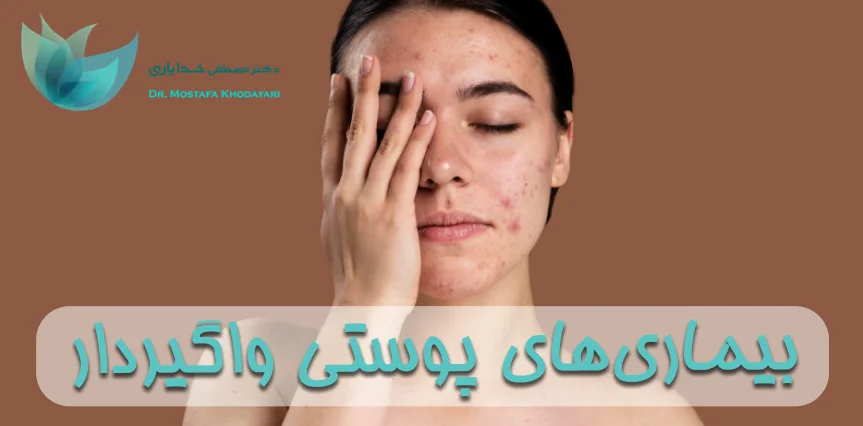 بیماریهای پوستی واگیردار بیماریهای پوستی واگیردار