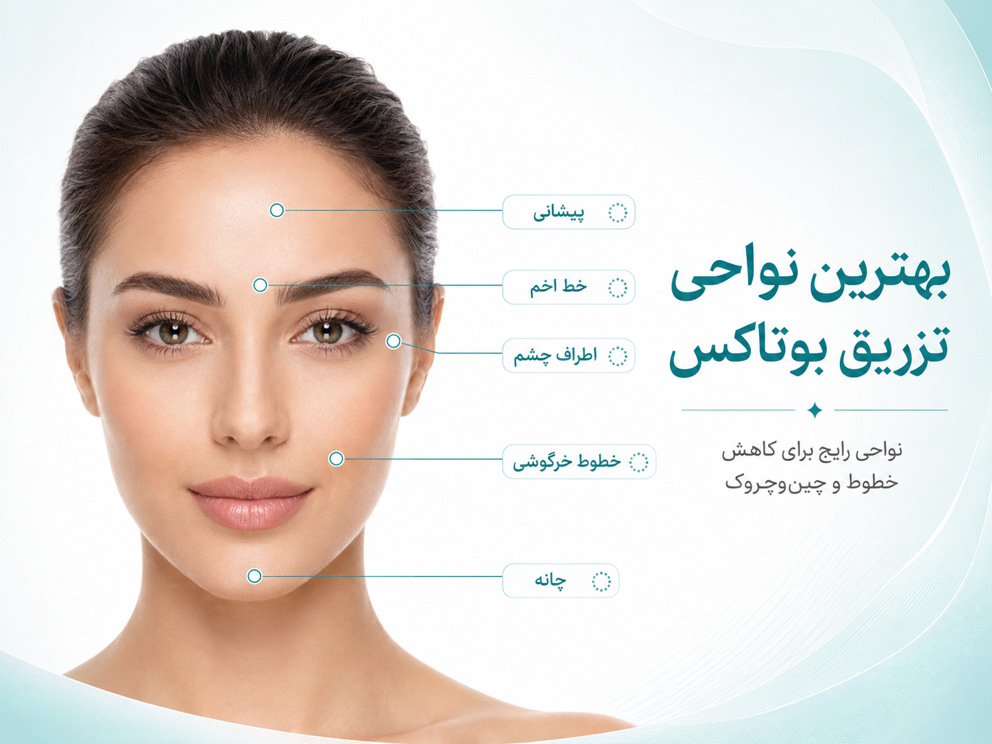 بهترین نواحی مناسب برای تزریق بوتاکس