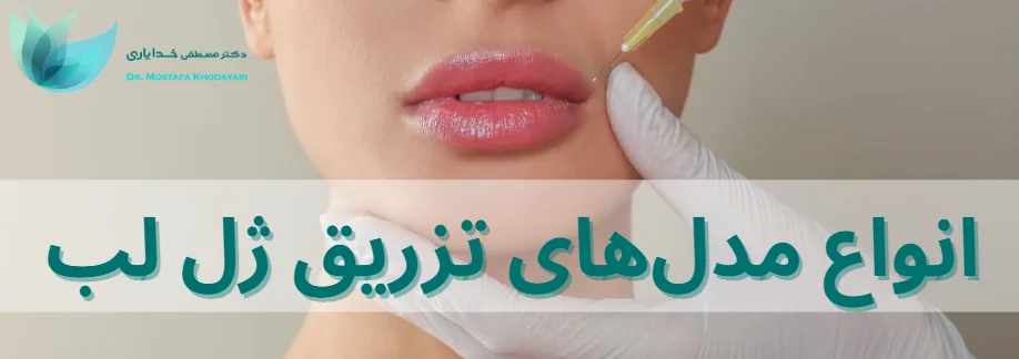 انواع مدلهای تزریق ژل لب انواع مدلهای تزریق ژل لب