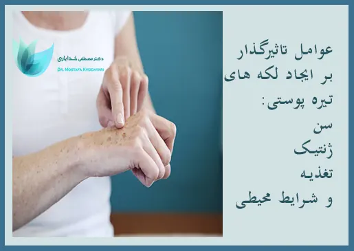 عوامل تاثیر گذار بر لکه های تیره پوستی