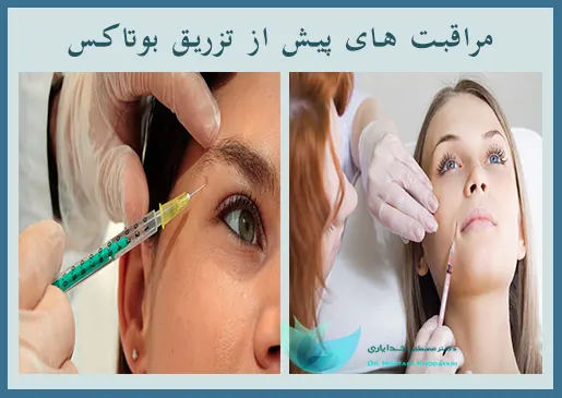 مراقبت پیش از بوتاکس