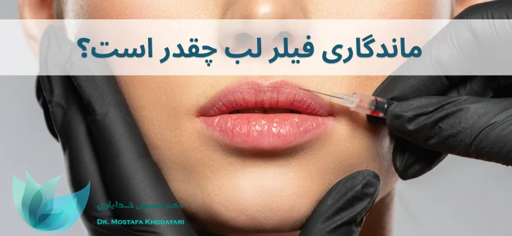 ماندگاری فیلر لب چقدر است؟ ماندگاری فیلر لب چقدر است؟