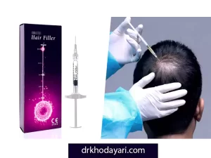 تزریق هیر فیلر