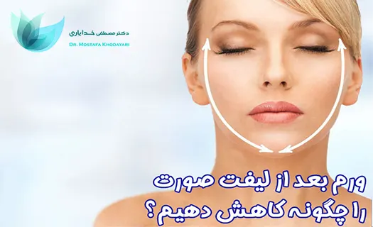 ورم بعد از عمل لیفت